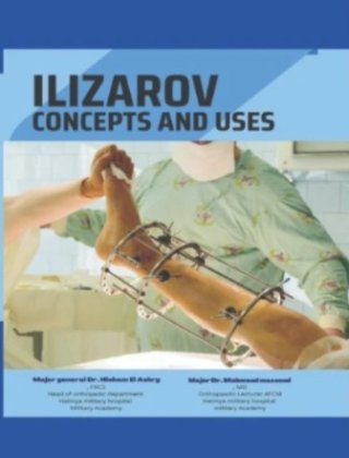 Notes : Ilizarov - Concepts and Uses